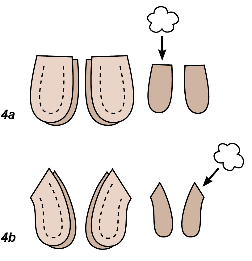 5 Place the front and back body pieces together with right sides facing pin - photo 5