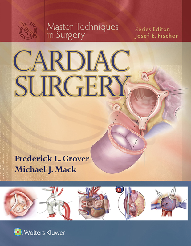 Master Techniques in Surgery CARDIAC SURGERY Edited by - photo 1