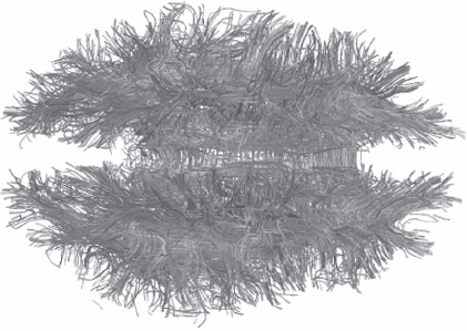 A view from the above of the paths of the axons through the two lobes of the - photo 3