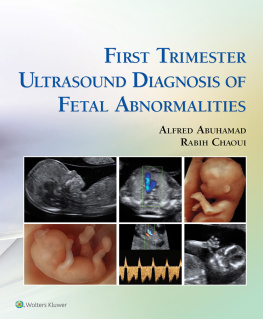 Alfred Z. Abuhamad - First Trimester Ultrasound Diagnosis of Fetal Abnormalities