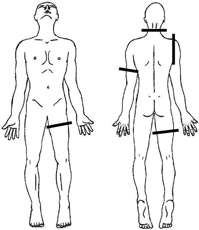 The position of the dismemberment cuts on Gemma McCluskie CHAPTER 10 Kosovo - photo 11