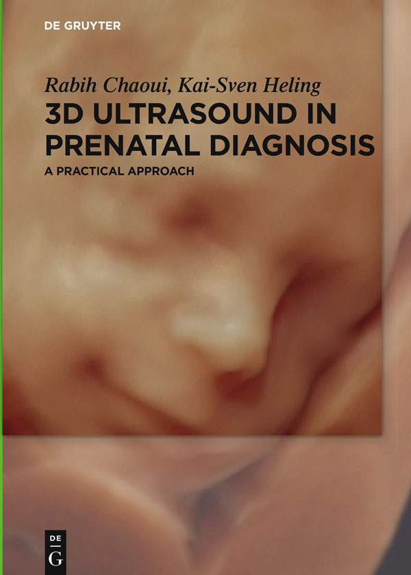 Rabih Chaoui Kai-Sven Heling 3D Ultrasound in Prenatal Diagnosis Prof Dr - photo 1