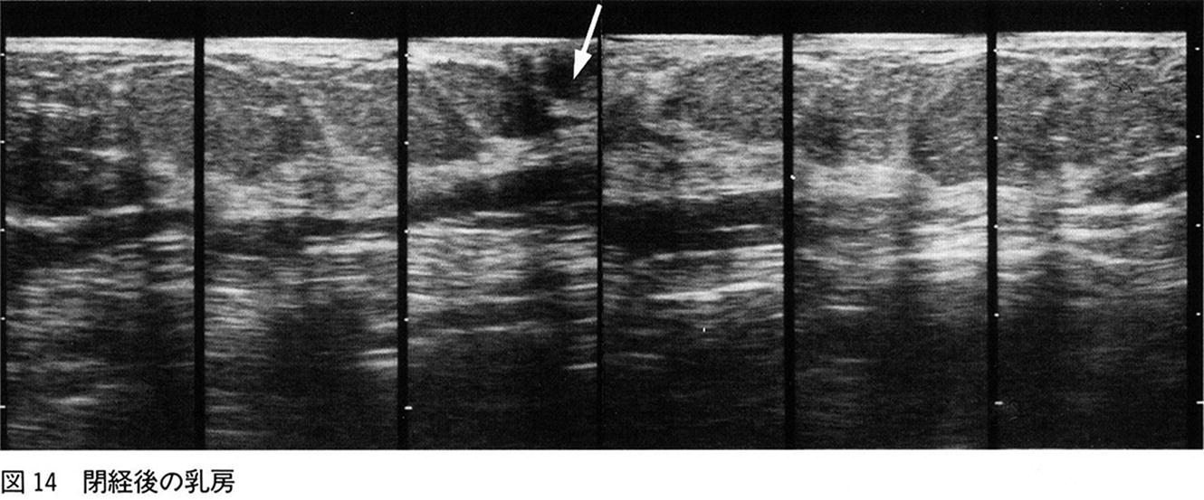 Fig 11 Large reconstructed breast ultrasound section presented by Pr EUENO - photo 1