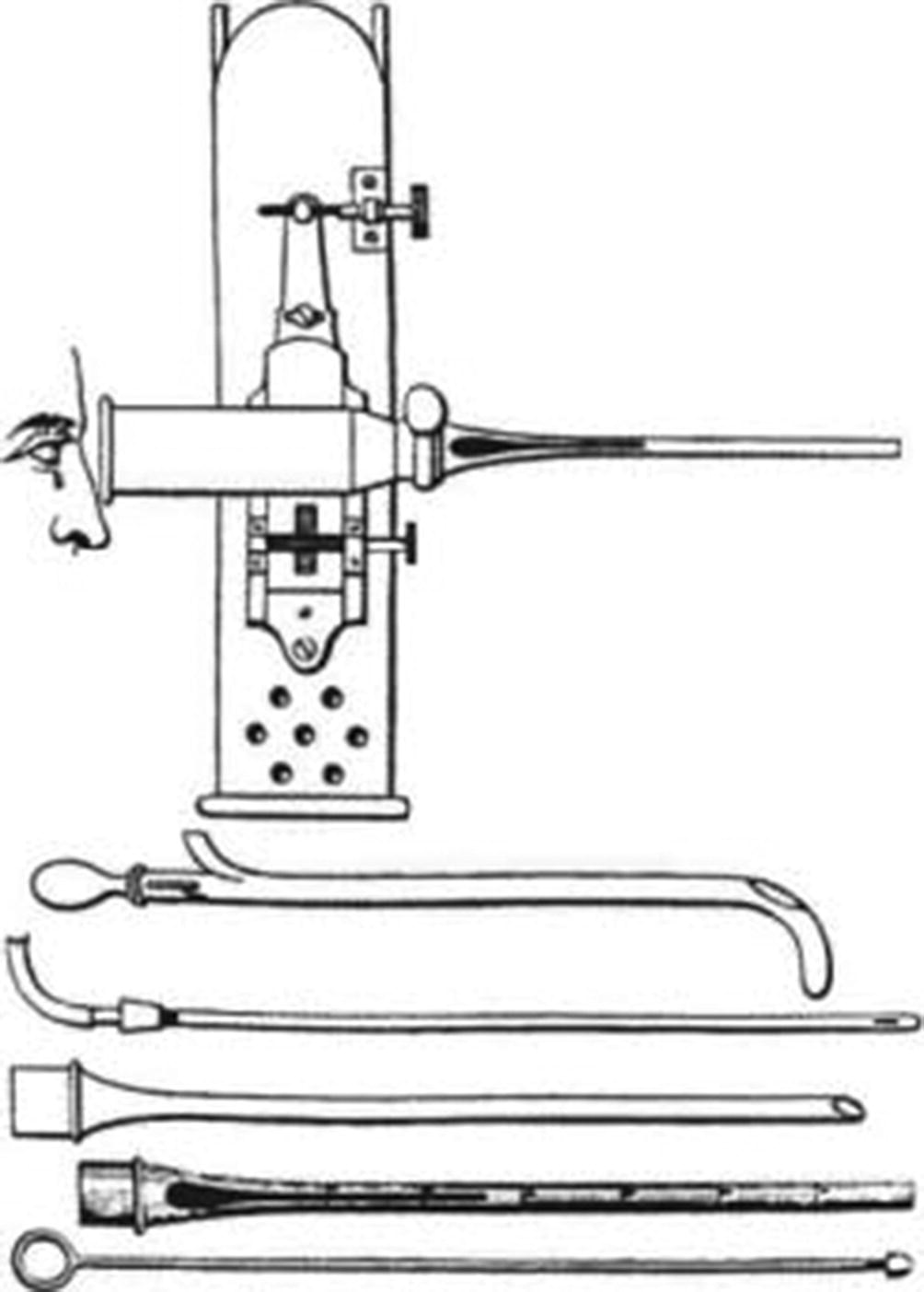 Fig 1 The endoscope used by F R Cruise in 1866 Desormeaux used the term - photo 1