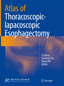 Yi Zhang Atlas of Thoracoscopic-lapacoscopic Esophagectomy