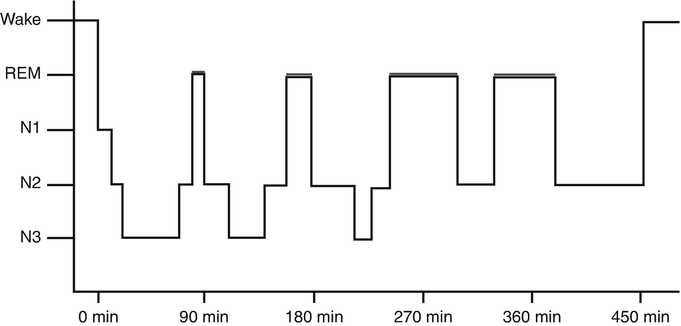 Fig 11 Normal hypnogram x axis time in minutes from sleep onset Y axis - photo 1