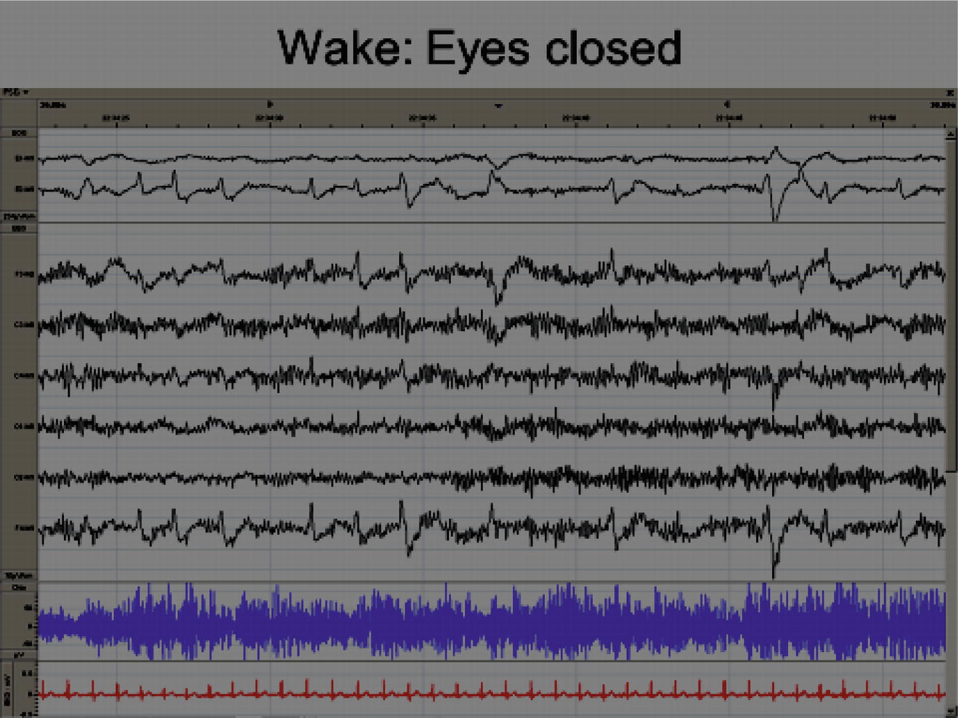 Fig 13 Wakefulness with eyes closed 122 Sleep Onset The perception of - photo 3