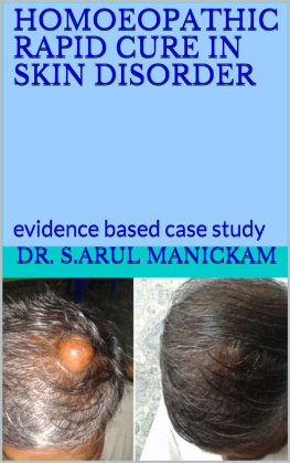 Dr. S.Arul manickam - HOMOEOPATHIC RAPID CURE IN SKIN DISORDER: evidence based case study