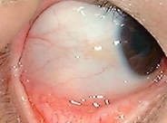 These two cases illustrate that eye reading diagnosis has insight on the state - photo 11