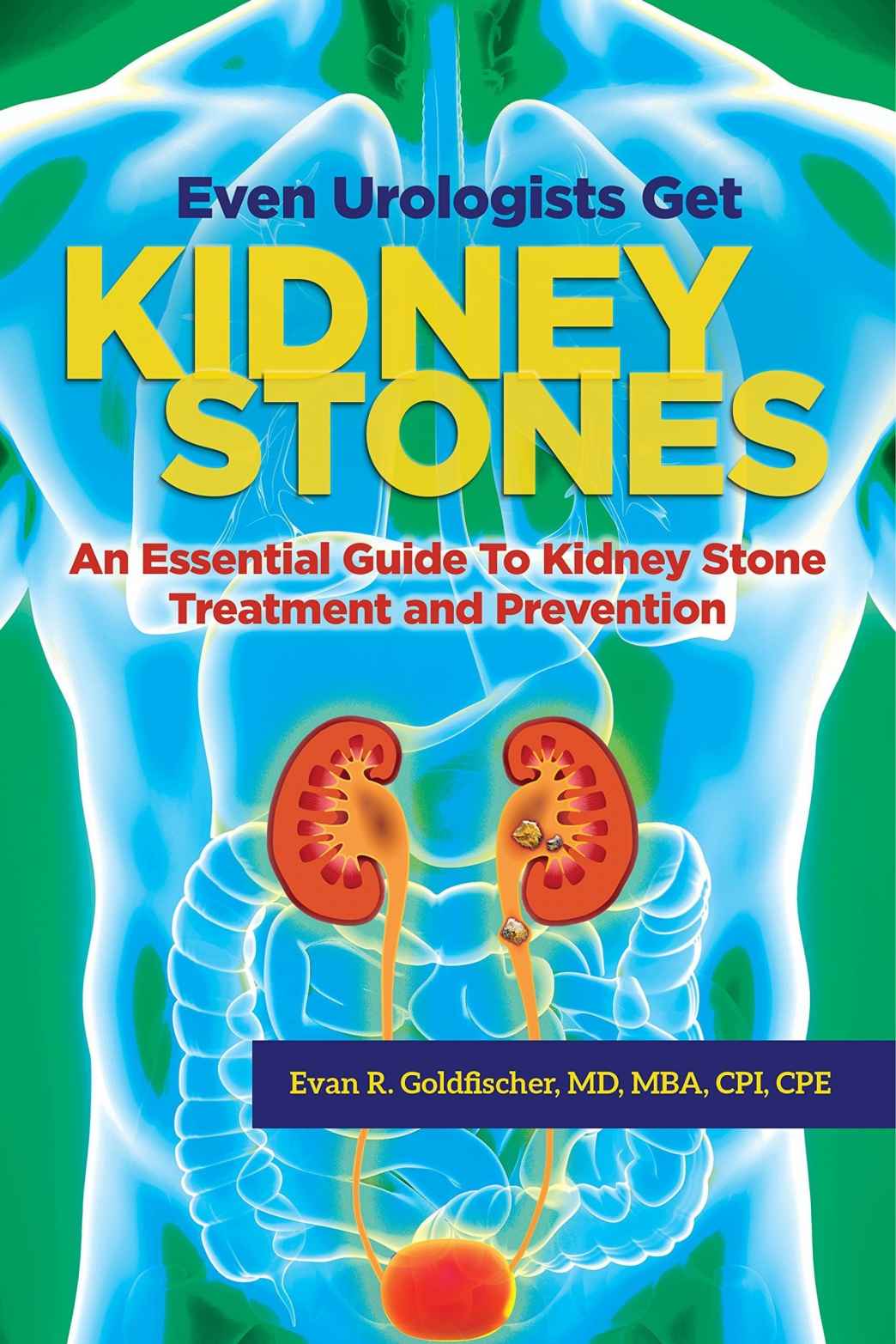 Evan R Goldfischer MD MBA CPI CPE Even Urologists Get Kidney Stones An - photo 1