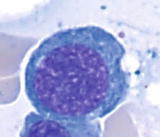 Smaller cells 1017 m than pronormoblast round nucleus high NC ratio 61 - photo 2