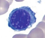 Smaller cells 1015 m and lower NC ratio 41 than basophilic normoblasts - photo 3