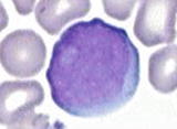 The most immature granulocytic cells 1520 m with high NC ratio 471 - photo 6