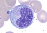 Size similar to or slightly smaller 1018 m than myelocytes with abundant - photo 9