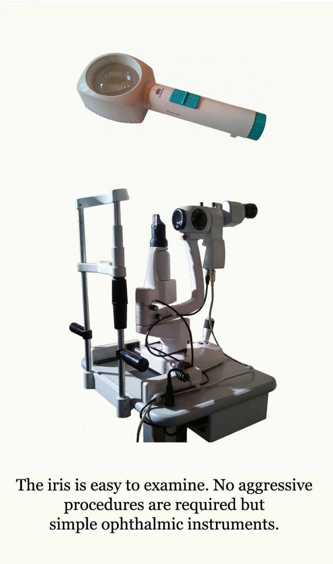 Iridology a definition Iridology studies the colored portion of the eye named - photo 2