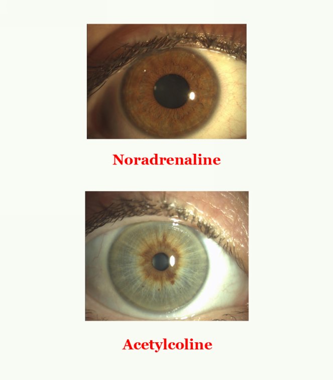 The pupils dilation shows a prevalence of the sympathetic nervous system - photo 3