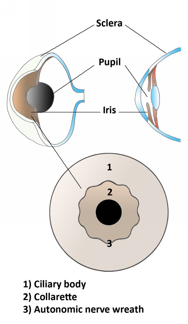 Main Morphologies IRIS COLOR The main characteristic of the iris is its - photo 7