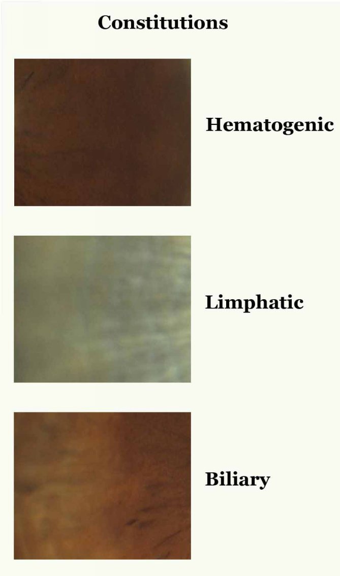 Main Markings Markings of various kinds can be present in the iris at the same - photo 8