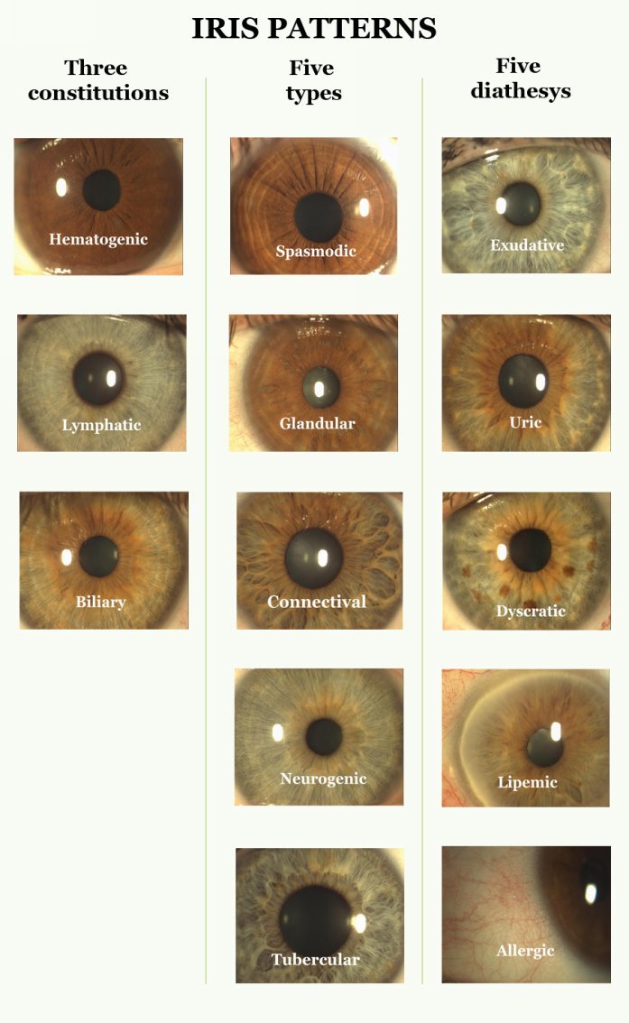 Main Markings Markings of various kinds can be present in the iris at the same - photo 9