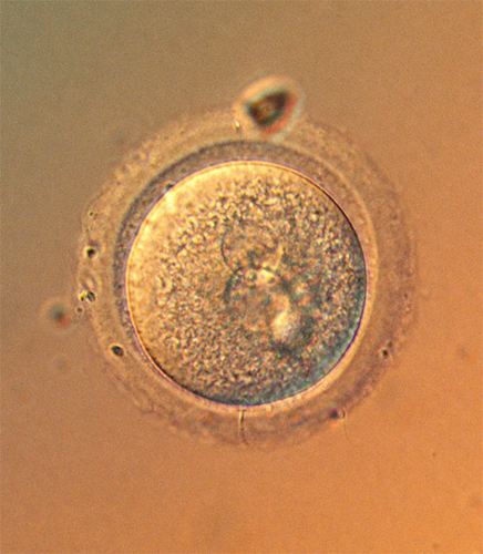 Two become one light micrograph a microscope photograph of a single - photo 3