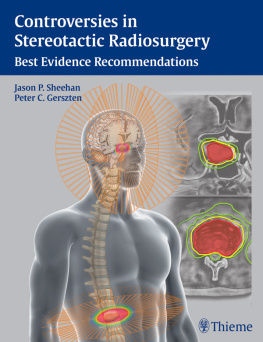 Jason P. Sheehan Controversies in Stereotactic Radiosurgery: Best Evidence Recommendations