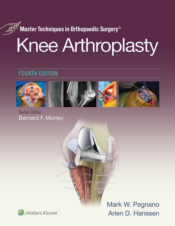 Master Techniques in Orthopedic Surgery Knee Arthroplasty - photo 1
