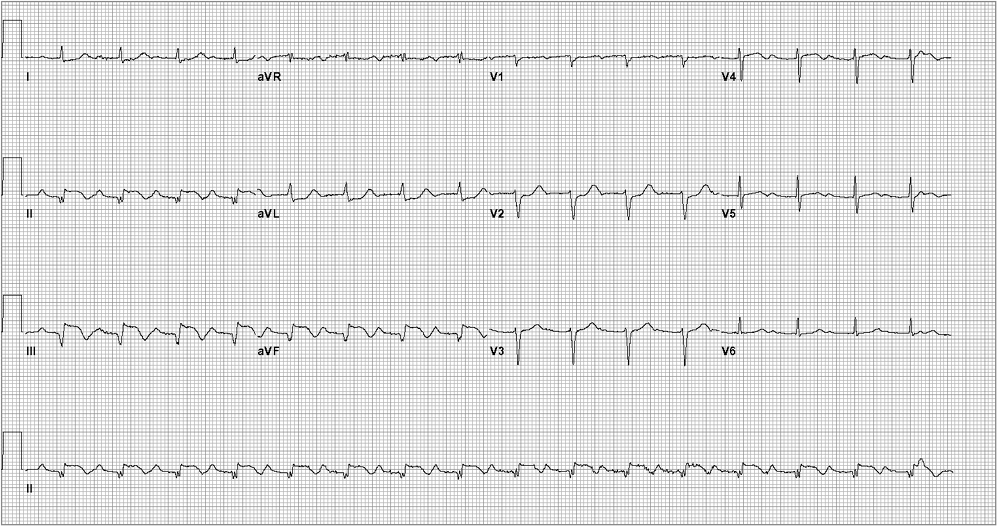 Which of the following is the best management for this patient Chest CT with - photo 2