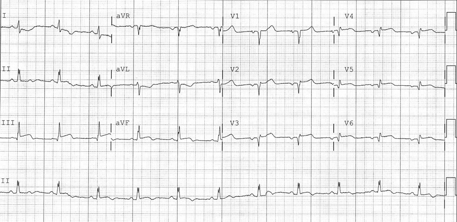 Which of the following should be given next in the treatment of this patient - photo 3