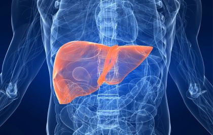 Fatty liver also known as steatosis is a general term that refers to the - photo 1