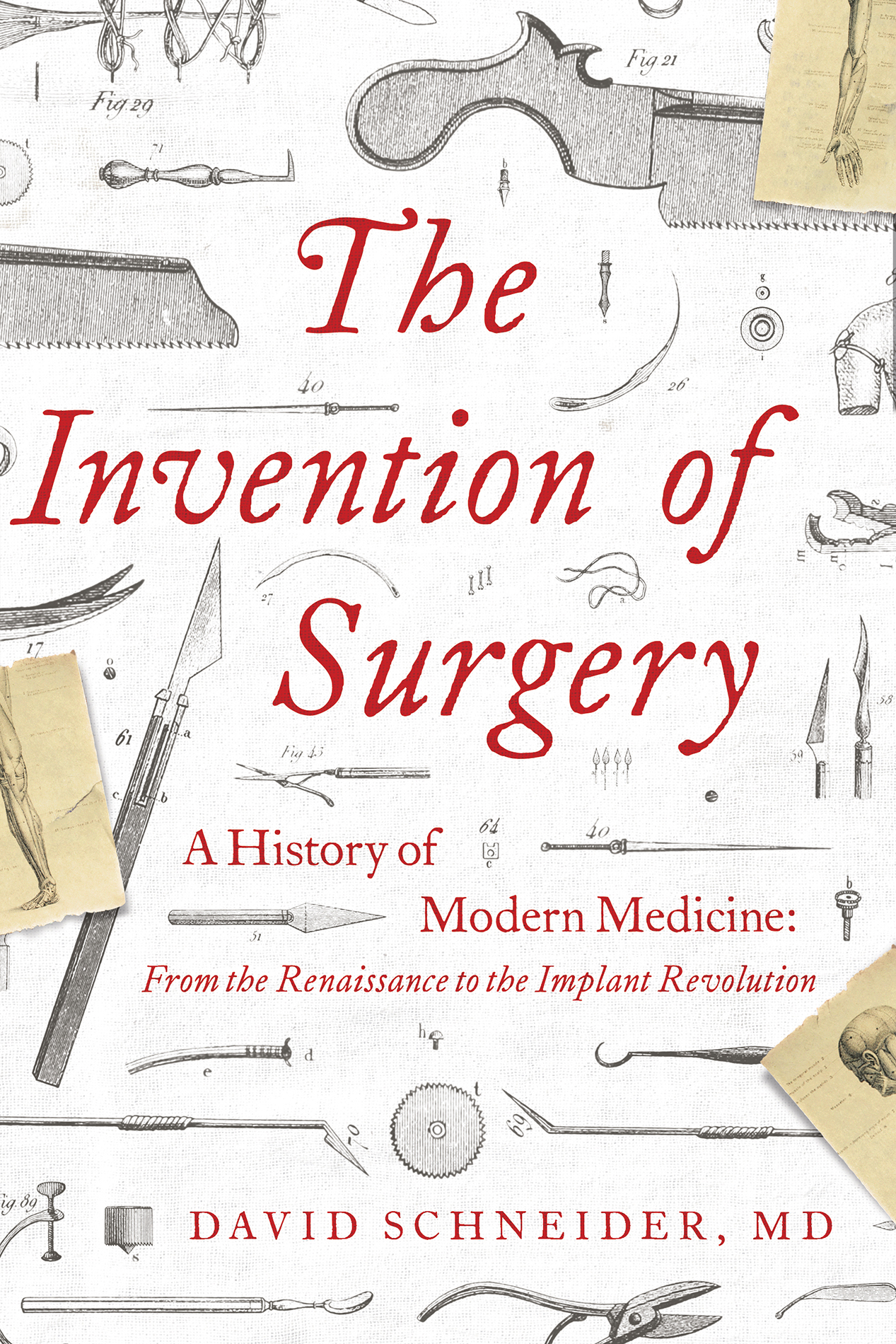 The Invention of Surgery A History of Modern Medicine From the Renaissance to the Implant Revolution - image 1