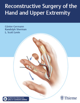 Germann Günter Reconstructive Surgery of the Hand and Upper Extremity