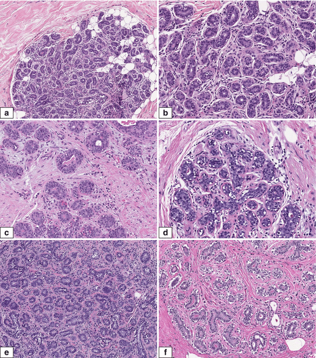 Fig 110 Normal adult female breast Histologic features of menstrual cycle - photo 12