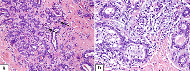 Fig 110 Normal adult female breast Histologic features of menstrual cycle - photo 13