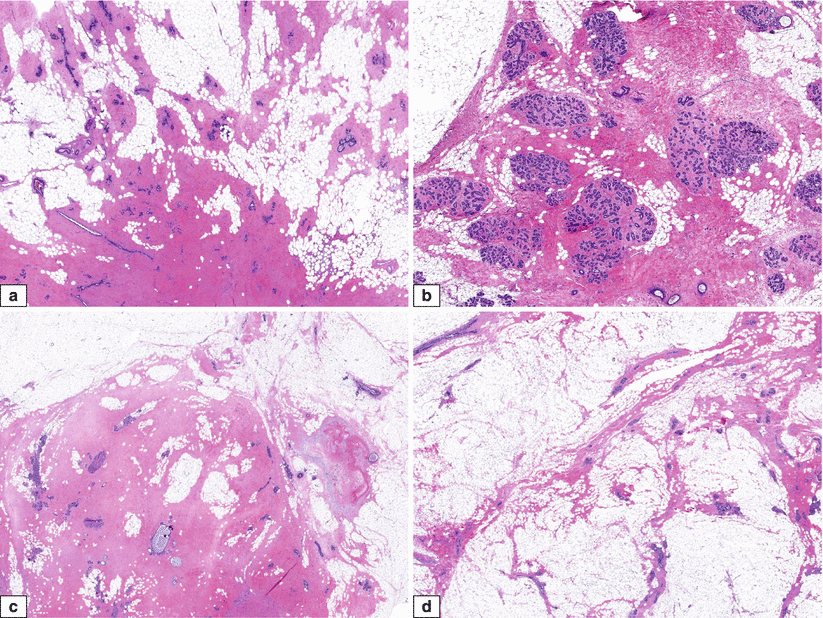 Fig 14 Normal adult female breast Histologic features ad HE sections - photo 4