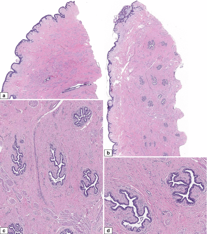 Fig 15 Normal adult female breast Histologic features ad HE sections - photo 5