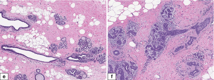 Fig 15 Normal adult female breast Histologic features ad HE sections - photo 6