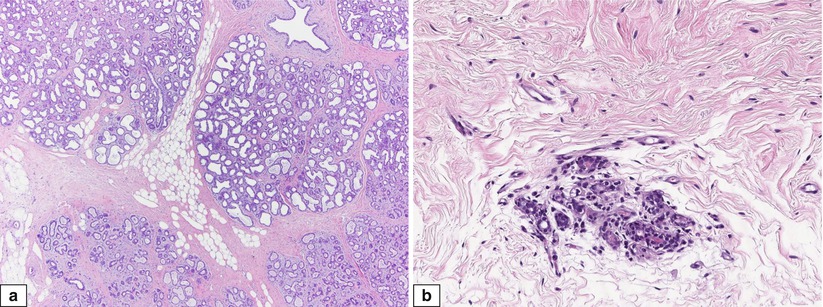 Fig 16 Normal adult female breast with physiological changes Histologic - photo 7