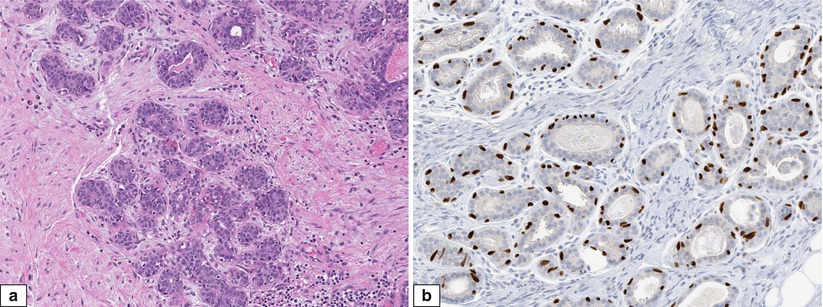 Fig 18 Normal adult female breast Histologic and immunohistochemical - photo 9