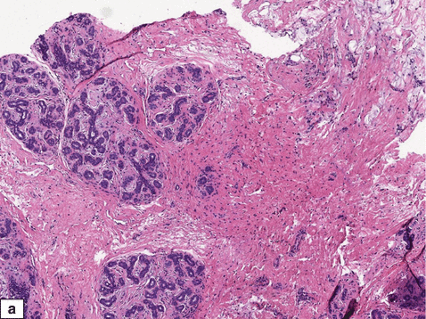 Fig 19 Normal adult female a b Stroma shows myoid cells in addition to - photo 10