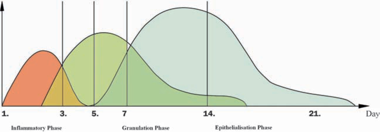 Figure 11 Time course and overlapping of the three distinct phases of wound - photo 1