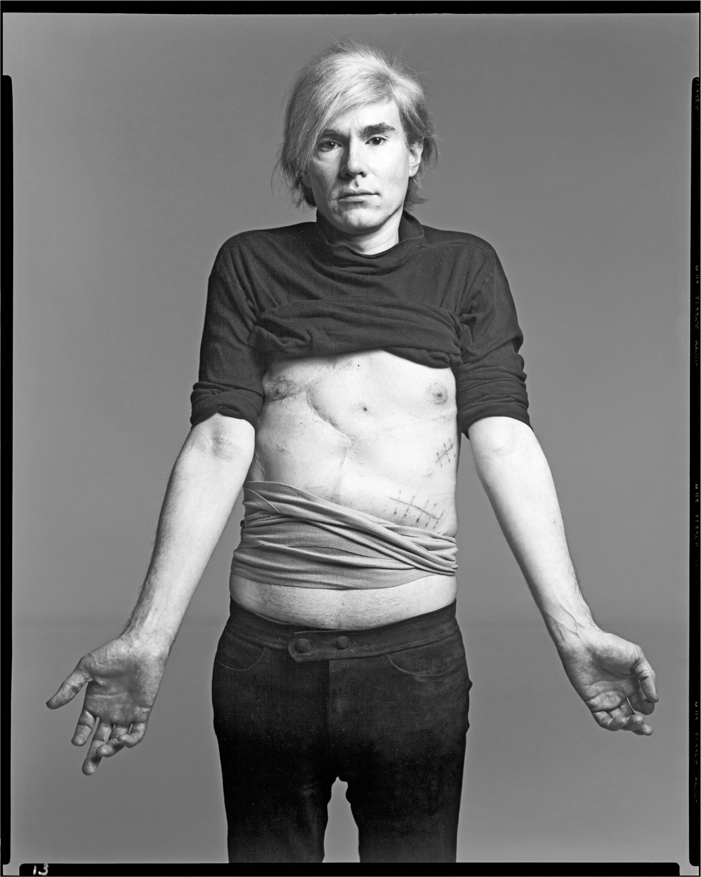 Warhol showing the scars from his shooting Richard Avedon Andy Warhol - photo 2