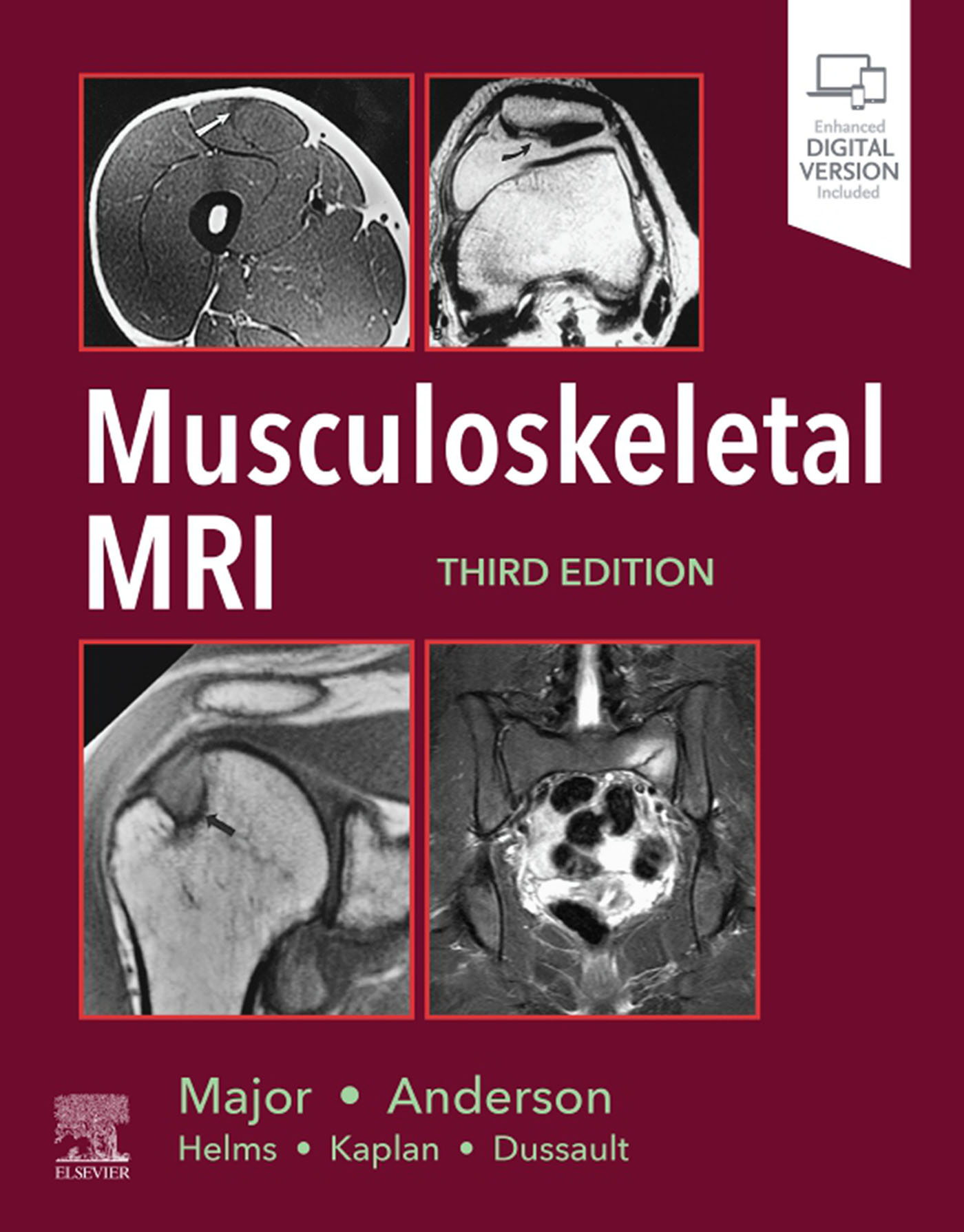 Musculoskeletal MRI Third Edition Nancy M Major MD Professor of Radiology - photo 1