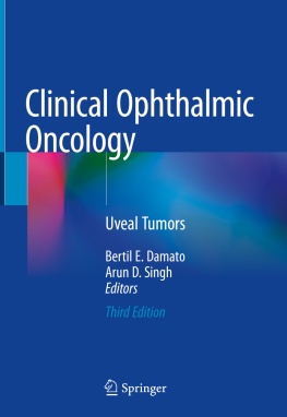 Bertil E. Damato Clinical Ophthalmic Oncology: Uveal Tumors