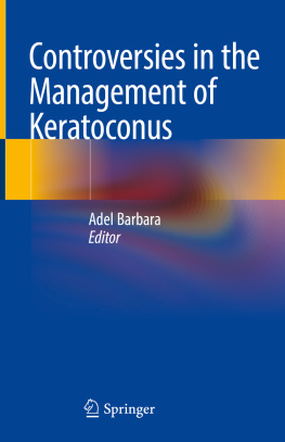 Adel Barbara - Controversies in the Management of Keratoconus
