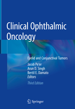 Jacob Peer - Clinical Ophthalmic Oncology: Eyelid and Conjunctival Tumors