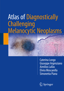 Caterina Longo - Atlas of Diagnostically Challenging Melanocytic Neoplasms