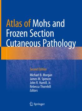 Michael B. Morgan - Atlas of Mohs and Frozen Section Cutaneous Pathology