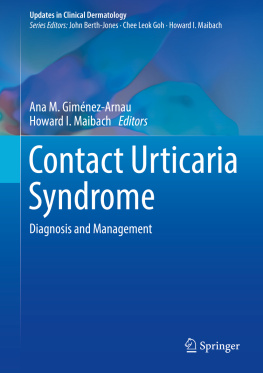 Ana M. Giménez-Arnau Contact Urticaria Syndrome: Diagnosis and Management