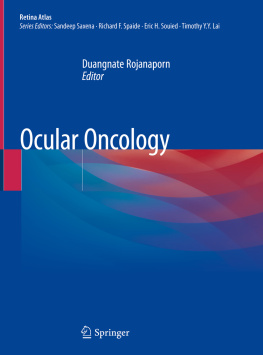 Duangnate Rojanaporn - Ocular Oncology