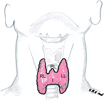 Figure 11 Anatomy of the thyroid gland I isthmus LL left thyroid lobe - photo 1